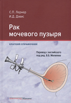 Рак мочевого пузыря