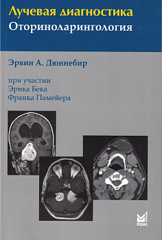 Лучевая диагностика. Оториноларингология. Лучевая диагностика. Оториноларингология.