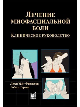 Лечение миофасциальной боли