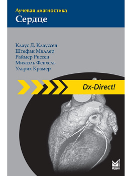 Лучевая диагностика. Сердце