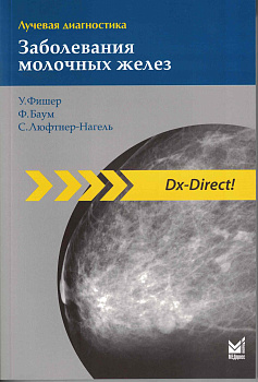 Лучевая диагностика. Заболевания молочных желез