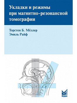 Укладки и режимы при магнитно-резонансной томографии