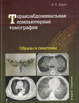 Торакоабдоминальная компьютерная томография