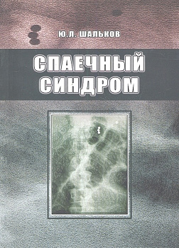 Спаечный синдром