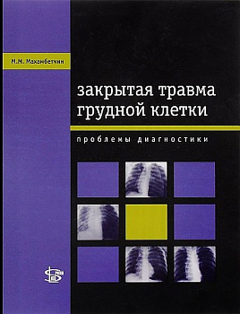 Закрытая травма грудной клетки: проблемы диагностики
