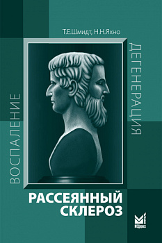 Рассеянный склероз