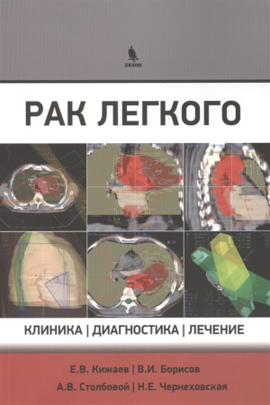 2458092_detail