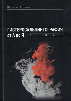 Гистеросальпингография от А до Я: атлас.