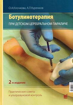Ботулинотерапия при ДЦП: практические советы и УЗИ-контроль.