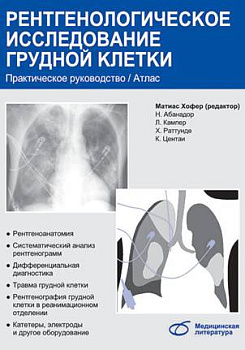 Рентгенологическое исследование грудной клетки
