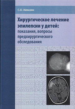 Хирургическое лечение эпилепсии у детей: показания, вопросы предхирургического обследования.