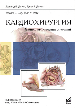 Кардиохирургия. Техника выполнения операций.