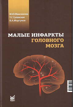 Малые инфаркты головного мозга
