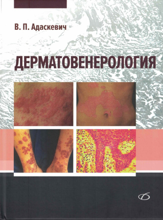 Дерматовенерология