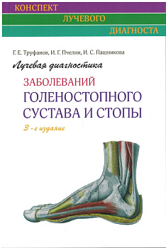 Лучевая диагностика заболеваний голеностопного сустава и стопы