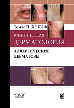 Клиническая дерматология. Аллергические дерматозы.