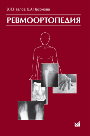 460_Revmoortopedija_mPavlovx (1)