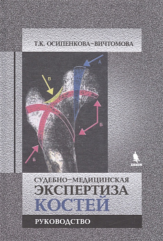 Судебно-медицинская экспертиза костей
