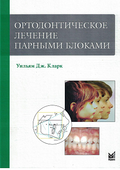 Ортодонтическое лечение парными блоками