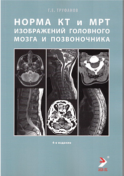 Норма КТ и МРТ изображений головного мозга и позвоночника. Атлас изображений