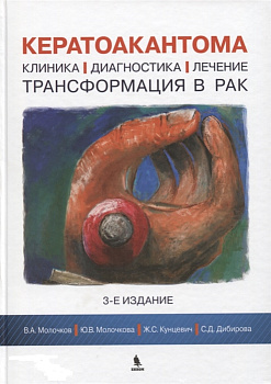Кератоакантома