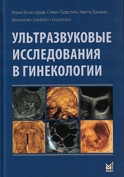 Ультразвуковые исследования в гинекологии