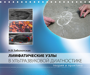Лимфатические узлы в ультразвуковой диагностике