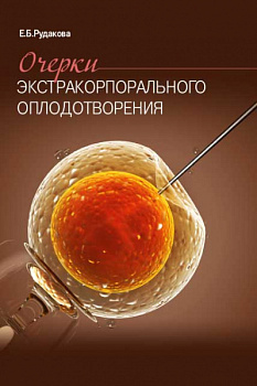 Очерки экстракорпорального оплодотворения.