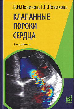 Клапанные пороки сердца.