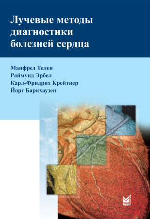 463_Luchevye_metody_diagnostiki_boleznej_serdca_eTelenp.jpg