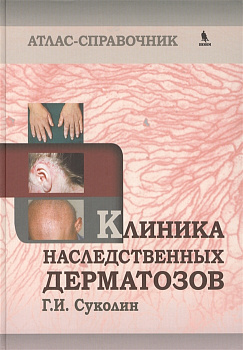 Клиника наследственных дерматозов