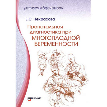 Пренатальная диагностика при многоплодной беременности