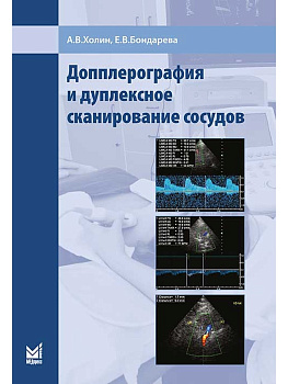 Допплерография и дуплексное сканирование сосудов