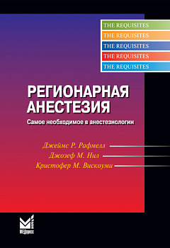 Регионарная анестезия