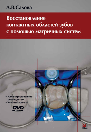 271_Vostanovlenie_kontaktnyh_oblactej_zubovrSalovau.jpg