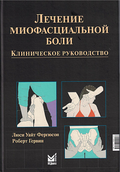 Лечение миофасциальной боли