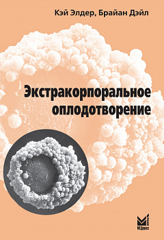 Экстракорпоральное оплодотворение