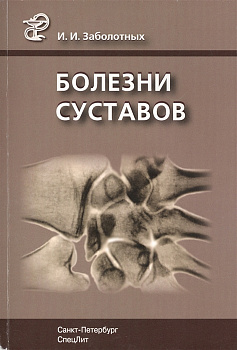 Болезни суставов
