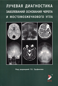 Лучевая диагностика заболеваний оснований черепа и мостмозжечкового угла