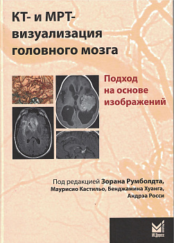 КТ- и МРТ- визуализация головного мозга. Подход на основе изображений