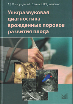 Ультразвуковая диагностика врожденных пороков развития плода.