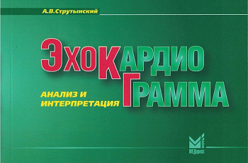 Эхокардиограмма: анализ и интерпретация