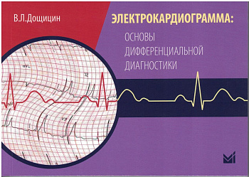 Электрокардиограмма: основы дифференциальной диагностики