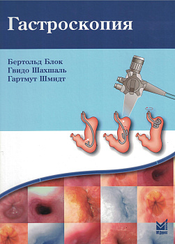 Гастроскопия