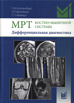 МРТ костно-мышечной системы. Дифференциальная диагностика