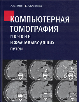 Компьютерная томография печени и желчевыводящих путей