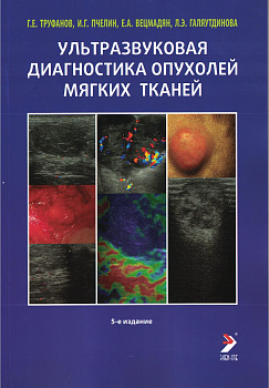Ультразвуковая диагностика опухолей мягких тканей