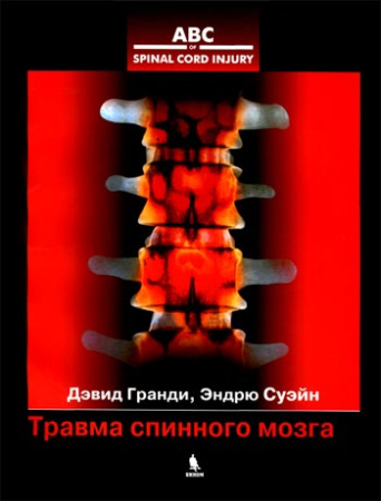 travma-spinnogo-mozga-grundy-swain-350a
