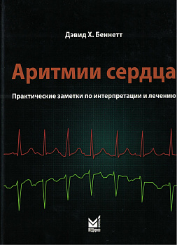 Аритмии сердца. Практические заметки по интерпретации и лечению. 