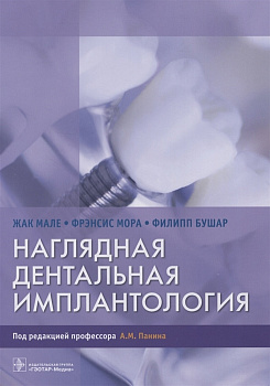Наглядная дентальная имплантология